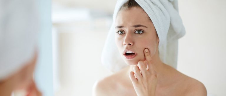 Pimple squeezing –  yes or no?