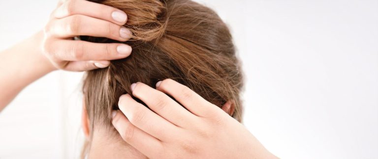 Dry and itchy scalp