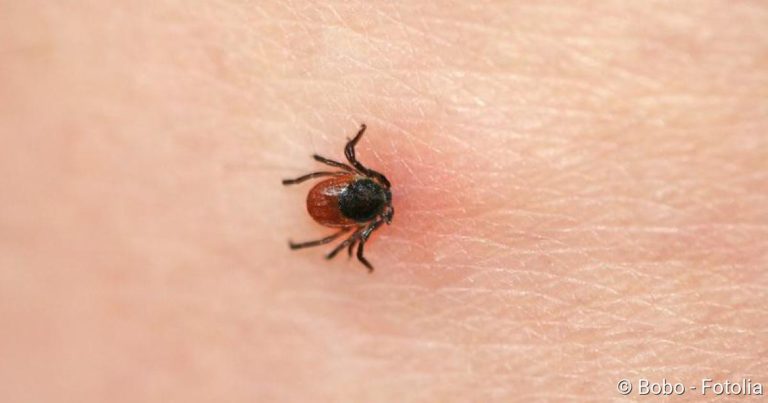 Lyme disease symptoms: How to recognize the disease