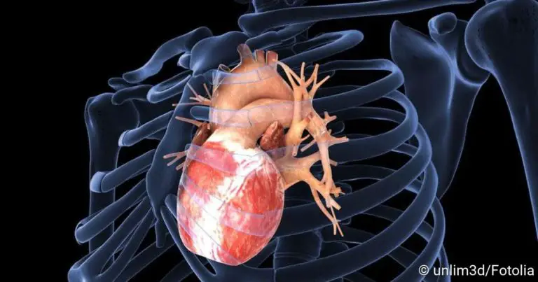 Coronary Artery Disease: causes, diagnosis, therapy