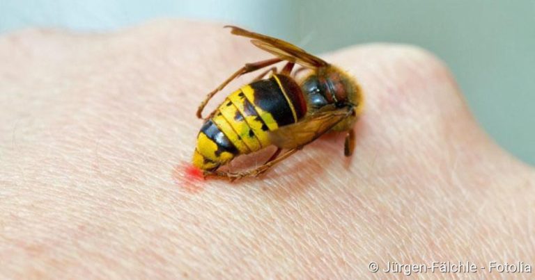 Insect bites: Appearance, complications, Prevention, Inflammation