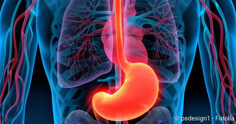 Reflux disease: causes, treatment, nutritional tips